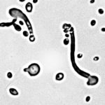 Researchers found a on-stop codon reassignment when they sequenced the genome of the yeast Pachysolen tannophilus. (Courtesy of Cletus-Kurtzman, USDA-ARS)