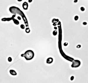 Researchers found a on-stop codon reassignment when they sequenced the genome of the yeast Pachysolen tannophilus. (Courtesy of Cletus-Kurtzman, USDA-ARS)