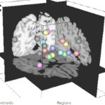 Brain Modulyzer combines multiple coordinated views