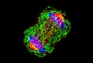 A triple-negative breast cancer cell (MDA-MB-231) in metaphase during cell division