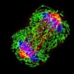 A triple-negative breast cancer cell (MDA-MB-231) in metaphase during cell division. (Image courtesy the National Cancer Institute)