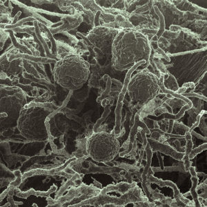 Scanning electron micrograph (SEM) of Neocallimastix californiae