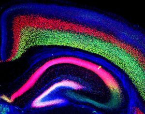 In this mouse cortex, a mutation in the CHD8 gene caused increased brain size, a condition also present in people with autism spectrum disorder