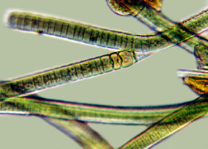 Filamentous blue-green algae <em>Tolypothrix</em>