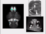 Brain-wide activity in a zebrafish when it sees and tries to pursue prey