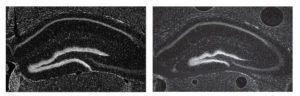 Part of normal mouse forebrain compared with a mouse missing one ultraconserved enhancer.