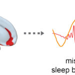 Greater levels of pathological tau protein, primarily in the brain’s medial temporal lobe (orange and yellow at bottom in cross section of the brain), were associated with weaker synchrony of slow waves (red) and sleep spindles (orange), two brain waves important for storing memories while we sleep. (Credit: Matthew Walker and Joseph Winer/UC Berkeley)