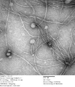 EM image of Pseudomonas phage Pf, an inovirus infecting Pseudomonas hosts. Inovirus capsids are long flexible filaments visible here after sample concentration and precipitation. (Courtesy of J. Driver and P. Secor, University of Montana)