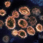 Transmission electron microscope image showing SARS-CoV-2, the virus that causes COVID-19, isolated from a patient in the U.S. (Credit: NIAID)
