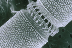 Zoomed in image of the shells from a marine diatom, Detonula pumila (Health Sciences and Nutrition, CSIRO)