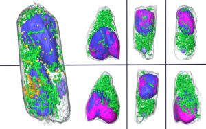 Soft X-ray tomographs of human lung cells infected with SARS-CoV-2