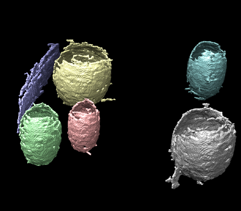 3D rendering of six regions obtained via the machine learning pipeline developed by Berkeley Lab scientists to improve cryo-ET image data analysis. Each region is labeled by a unique color.