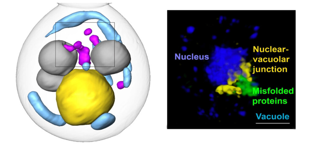 Two reconstructions of imaging: one soft x-ray tomographic reconstruction showing misfolded proteins in the cytoplasm being engulfed by vacuoles, the cell’s protein degradation machinery, and one super-resolution, visible-light microscopy reconstruction showing misfolded proteins being extruded from the nucleus toward a vacuole through a nuclear-vacuolar junction.