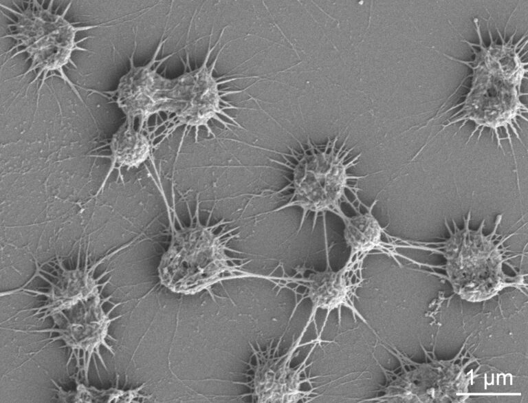 A grey microscopy photo taken at micron-scale. Microbes shown are small, round and slightly spiky in shape.
