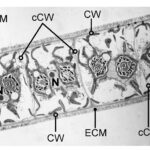 Close-up microscope image of connected algae cells. Each cell has a dark spot (nucleus) and circular structures. The cells are separated by thin walls and surrounded by a thick outer layer.