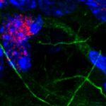 Immunofluorescent staining of mouse brain, showing neurons and glial cells in the hippocampus. Blue are cell nuclei, while green are microfilaments of the cell extensions. Red is a marker of DNA damage and is predominantly in the neurons.