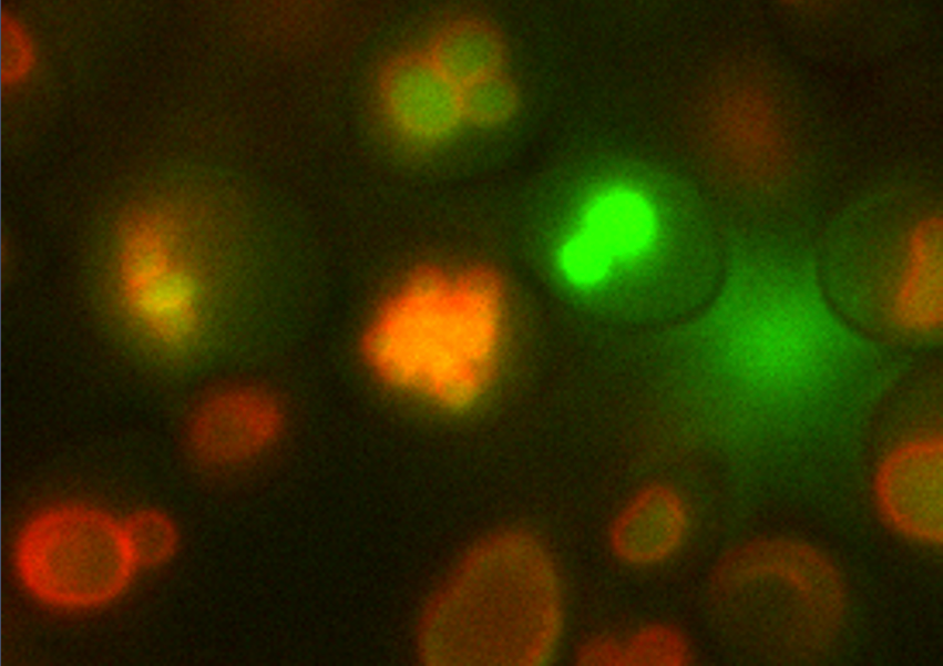 Microscopic view of fluorescent green and red shapes on a dark background.